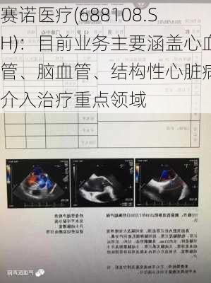 赛诺医疗(688108.SH)：目前业务主要涵盖心血管、脑血管、结构性心脏病等介入治疗重点领域